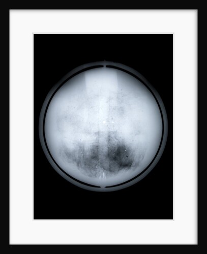 Globe x-ray by Charles Price