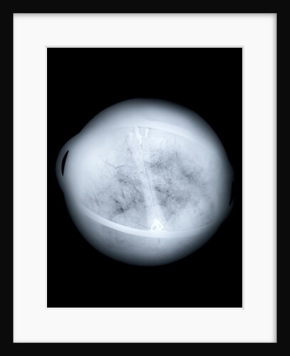 Globe x-ray by Charles Price