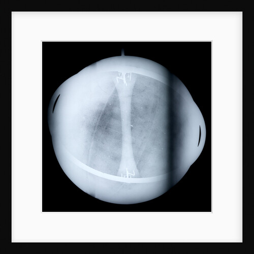 Globe x-ray by Jacques de La Feuille