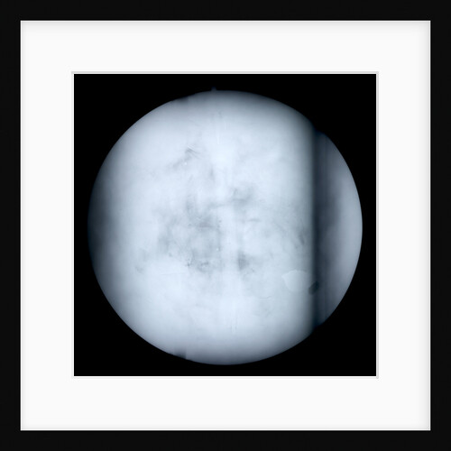 Globe x-ray by Robert Morden