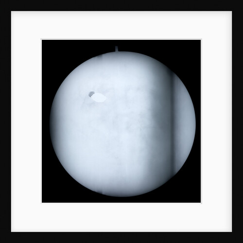 Globe x-ray by Robert Morden