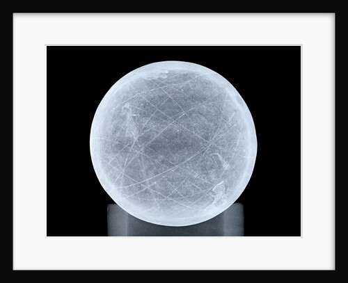 Globe x-ray by unknown