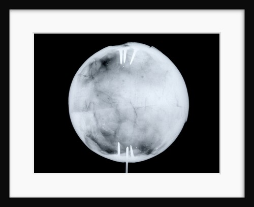 Globe x-ray by Herman Moll