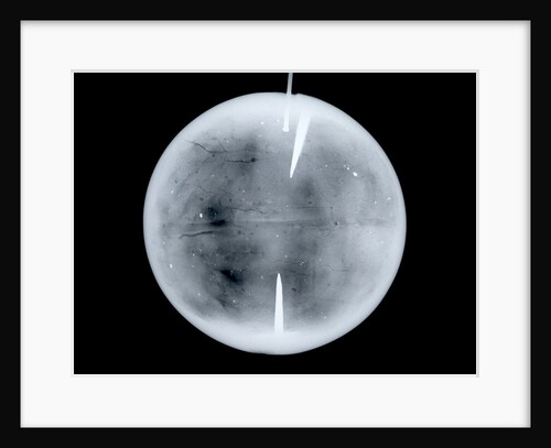 Globe x-ray by Dudley Adams