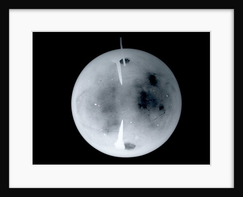 Globe x-ray by Dudley Adams