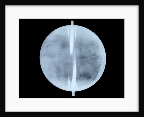 Globe x-ray by Thomas Patrick