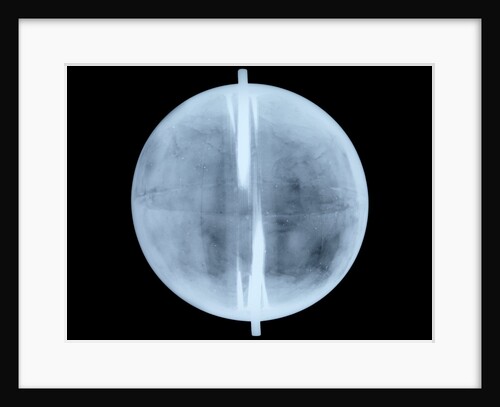 Globe x-ray by Thomas Patrick