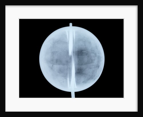 Globe x-ray by Thomas Patrick