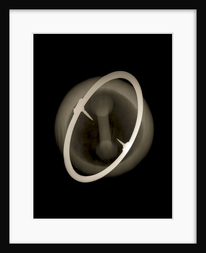 Globe x-ray by Joannes Oterschaden