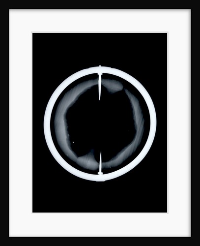 Globe x-ray by Joannes Oterschaden