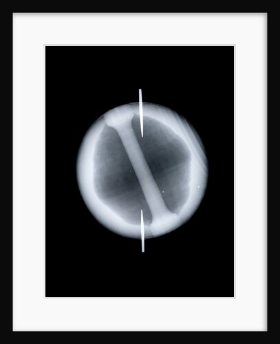 Globe x-ray by Joannes Oterschaden