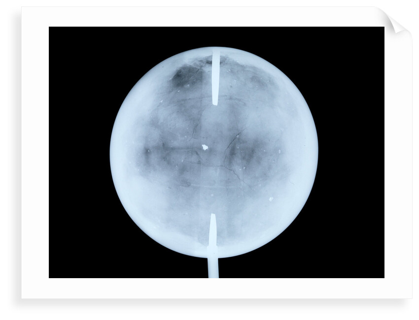 Globe x-ray by John Cary