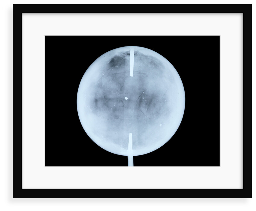 Globe x-ray by John Cary