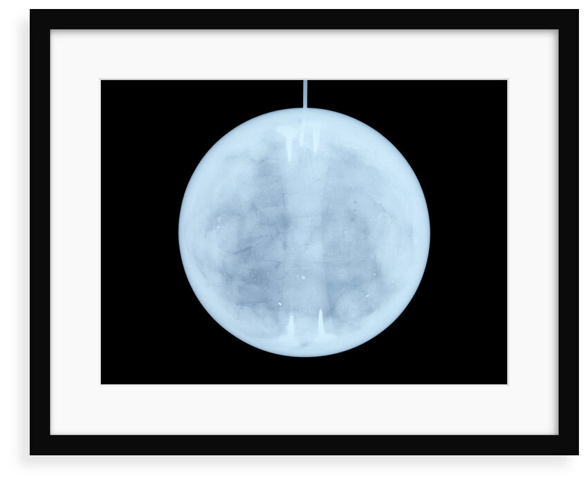 Globe x-ray by John Miller