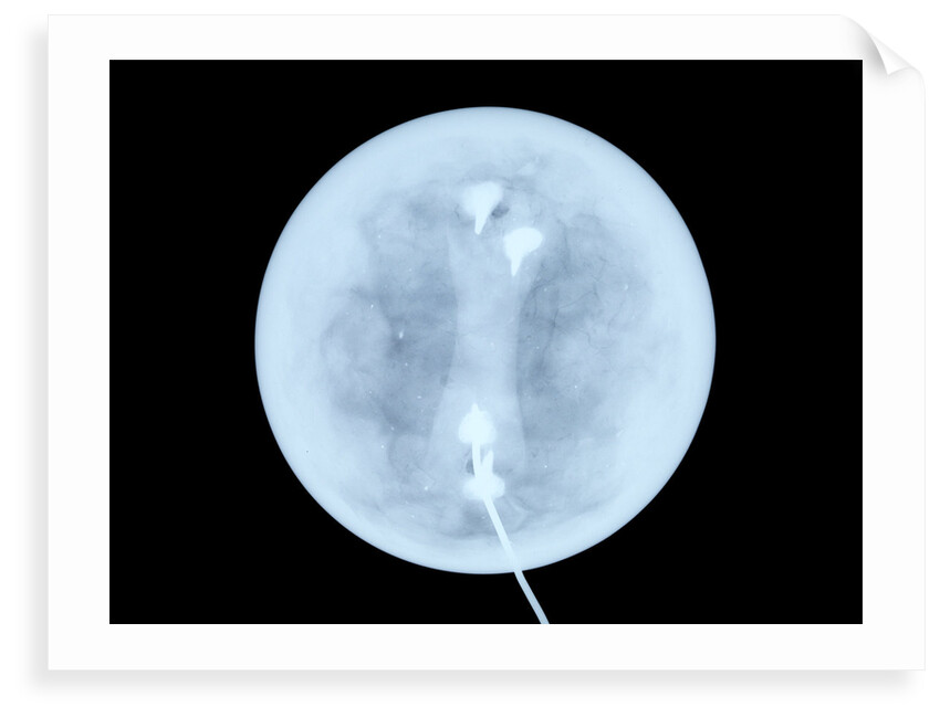 Globe x-ray by West