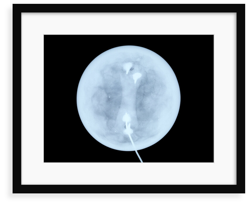 Globe x-ray by West