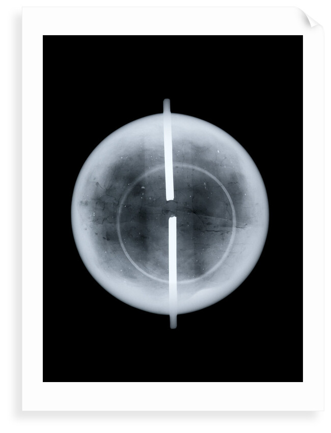 Globe x-ray by West