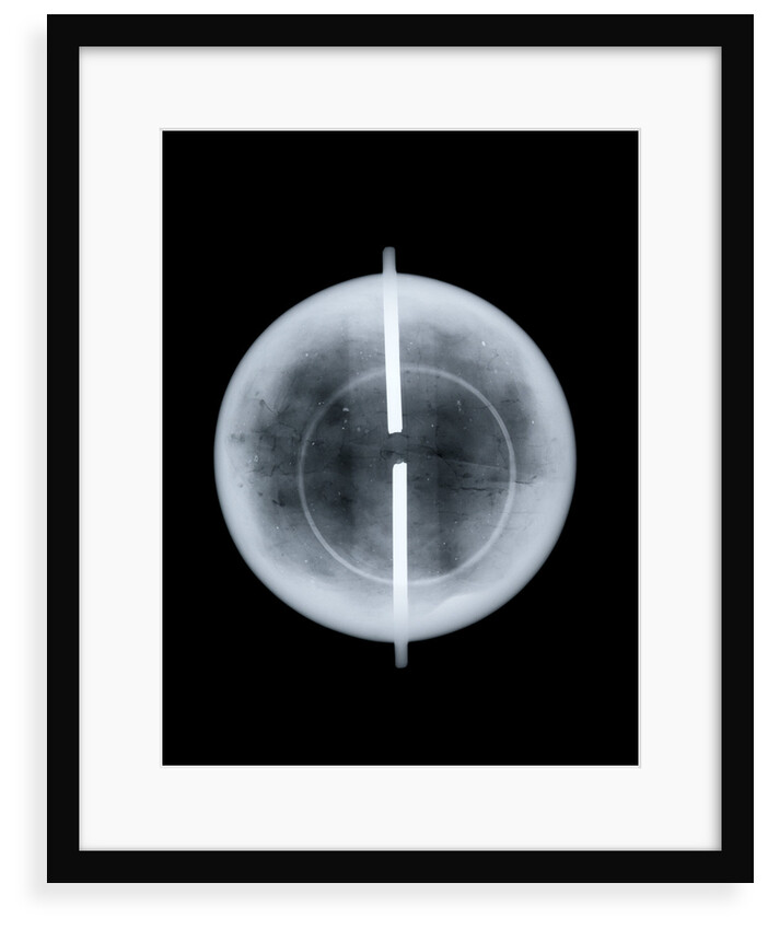Globe x-ray by West