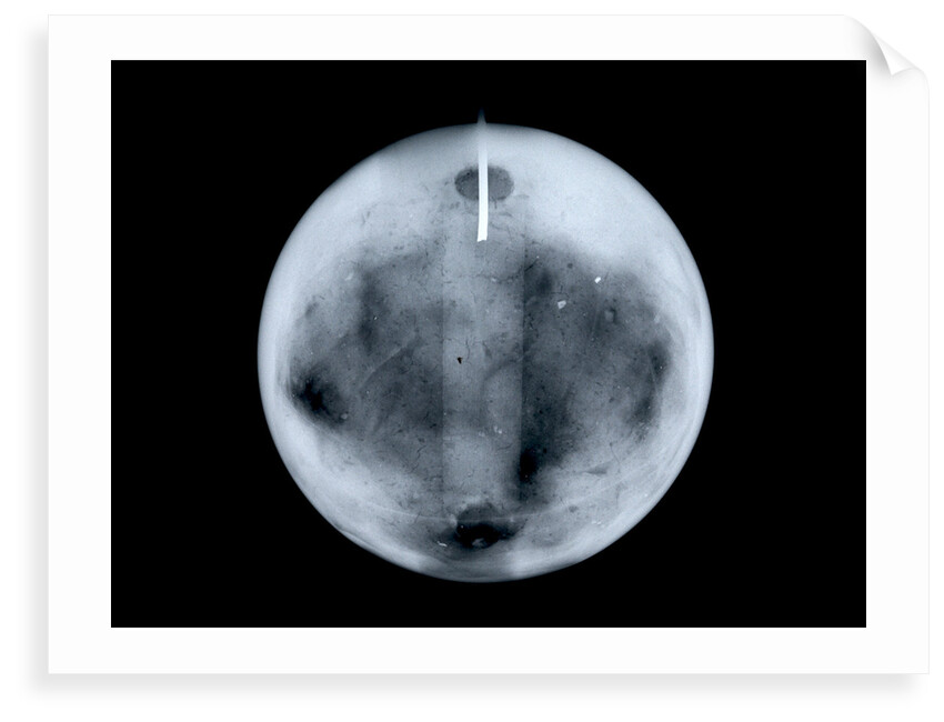 Globe x-ray by George Adams
