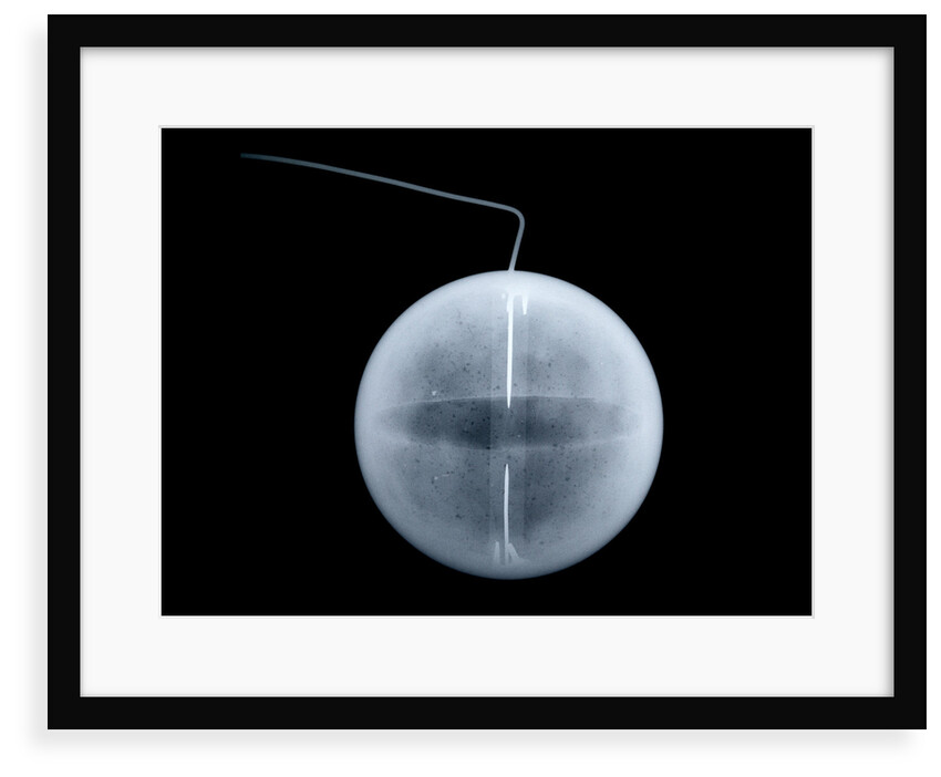 Globe x-ray by William Palmer
