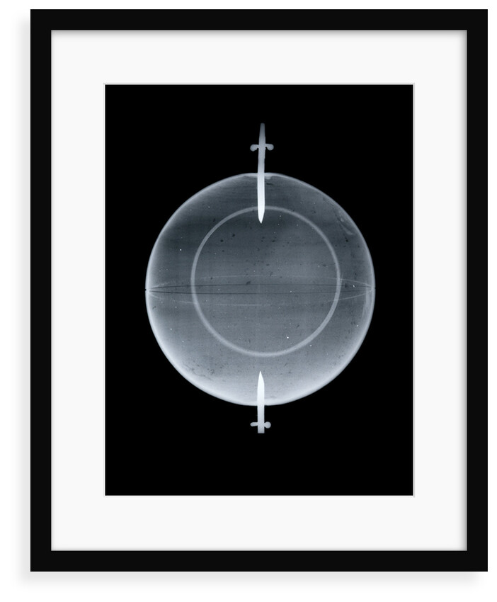Globe x-ray by Jean Fortin