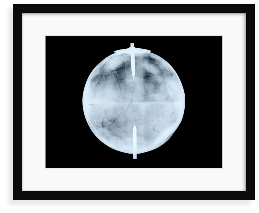 Globe x-ray by Dudley Adams