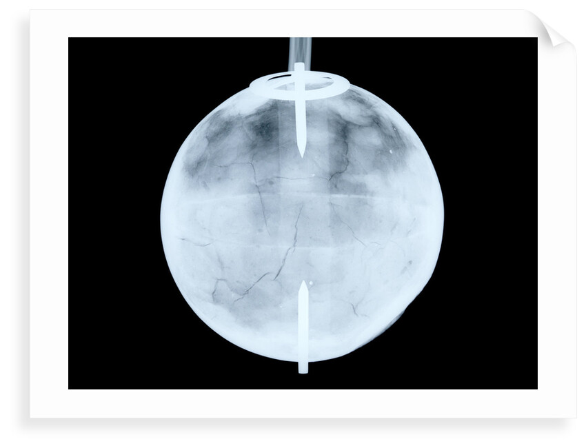 Globe x-ray by Dudley Adams