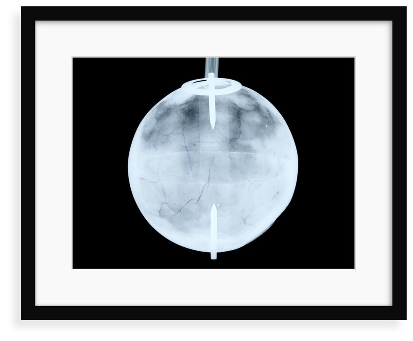 Globe x-ray by Dudley Adams