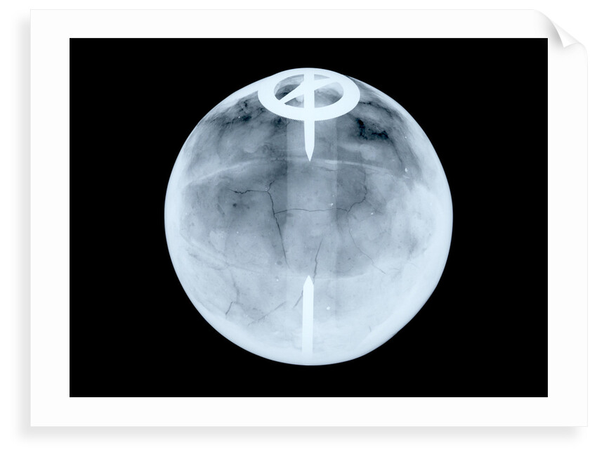 Globe x-ray by Dudley Adams