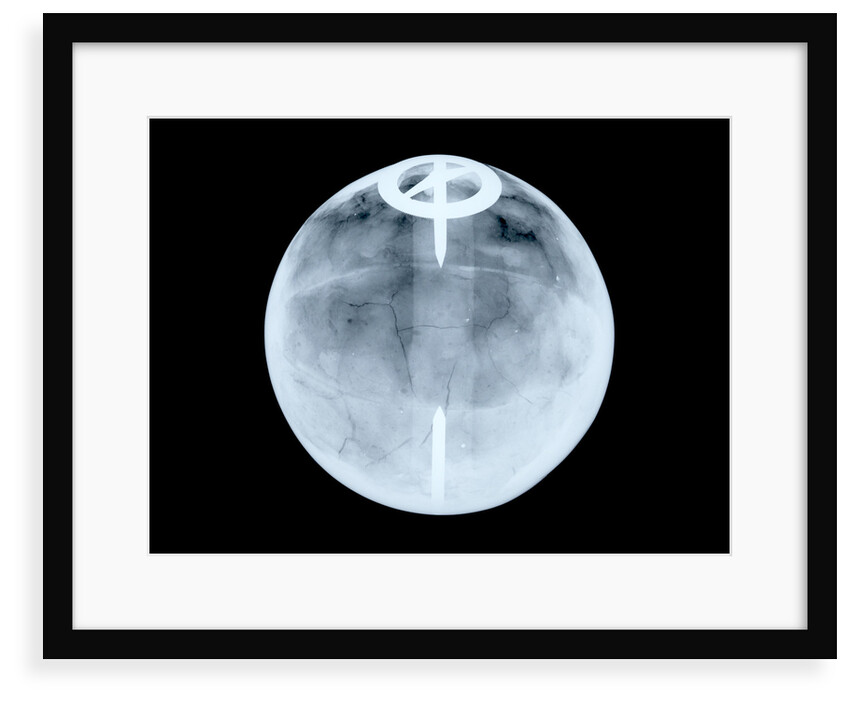Globe x-ray by Dudley Adams