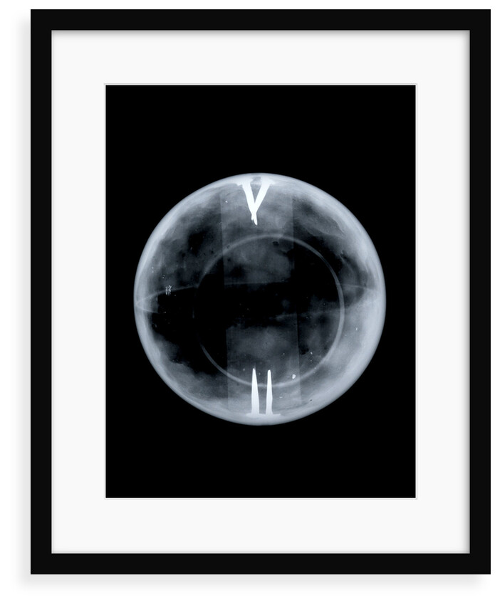 Globe x-ray by Richard Cushee