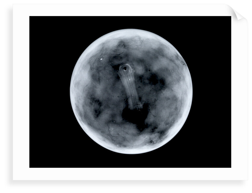 Globe x-ray by James Ferguson