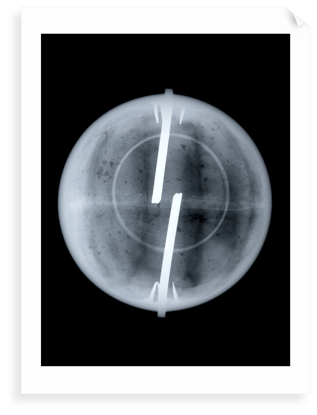 Globe x-ray by Newton & Co.