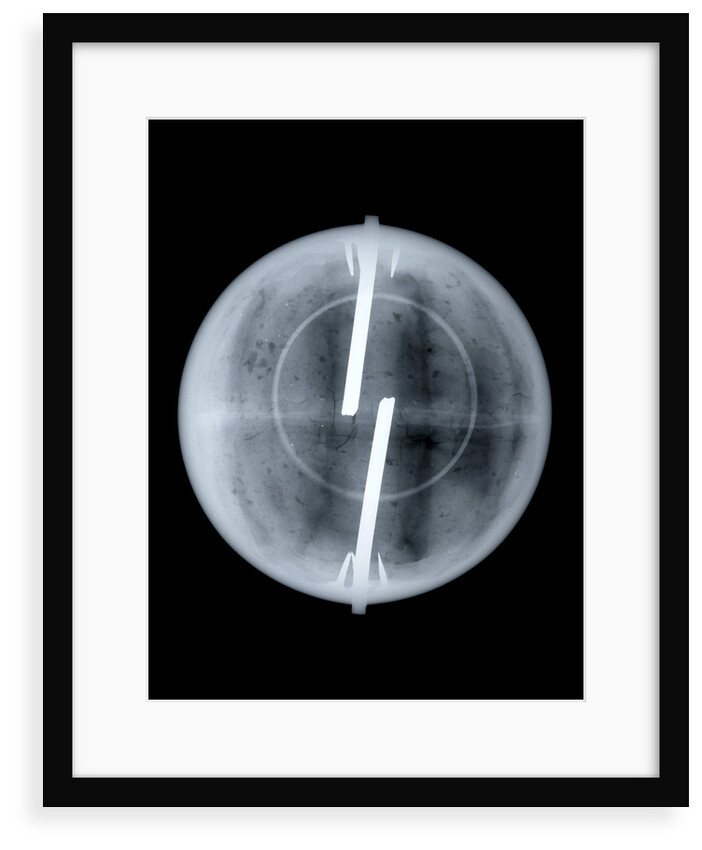 Globe x-ray by Newton & Co.