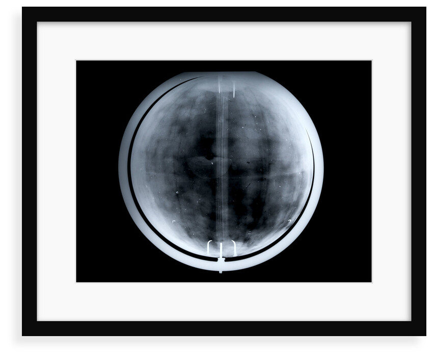 Globe x-ray by Johann Gabriel Doppelmayr
