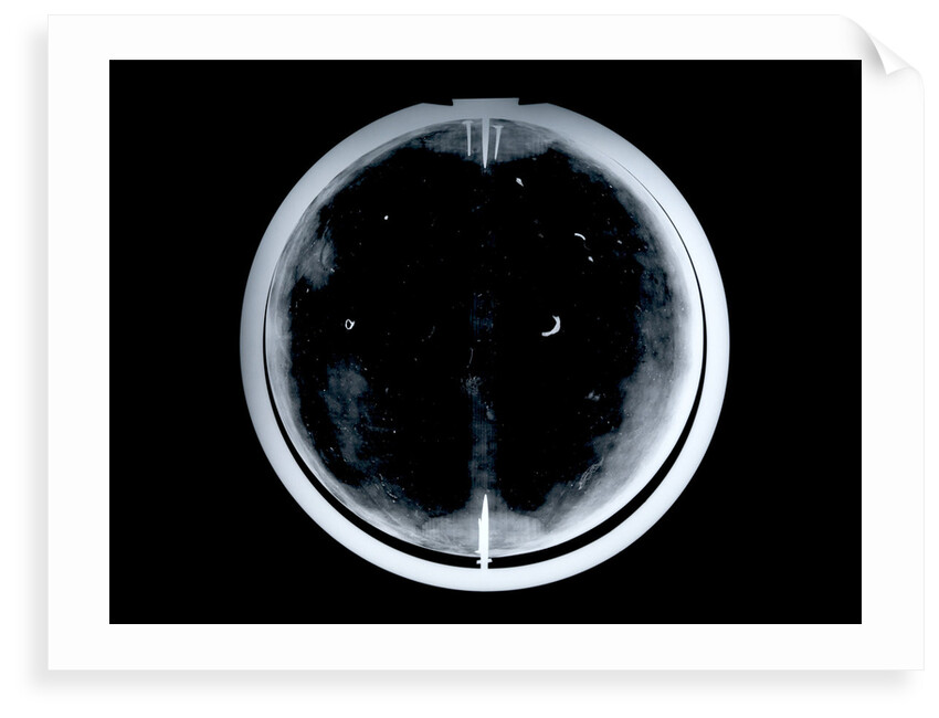 Globe x-ray by Johann Gabriel Doppelmayr