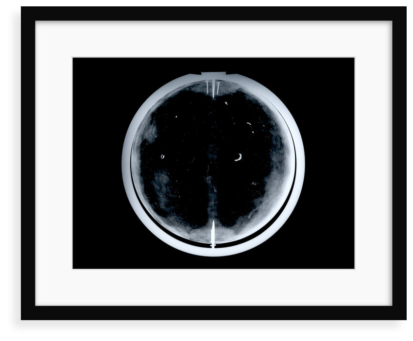 Globe x-ray by Johann Gabriel Doppelmayr