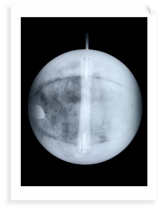 Globe x-ray by Benjamin Martin