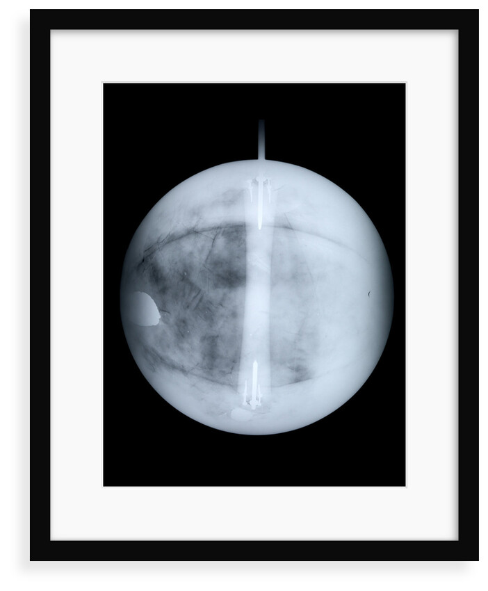 Globe x-ray by Benjamin Martin