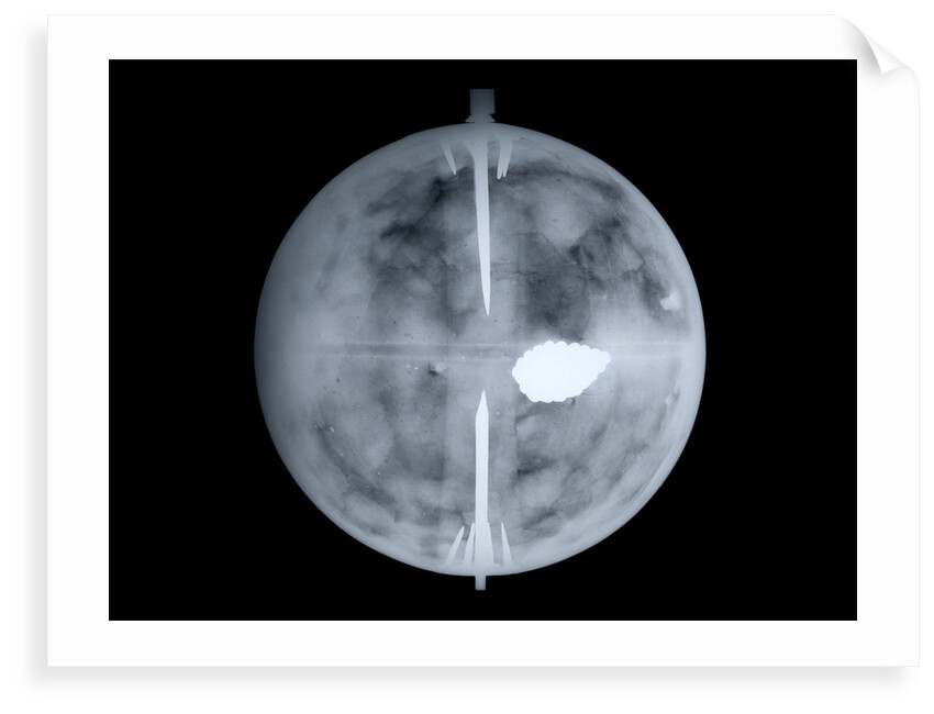 Globe x-ray by Nathaniel Hill
