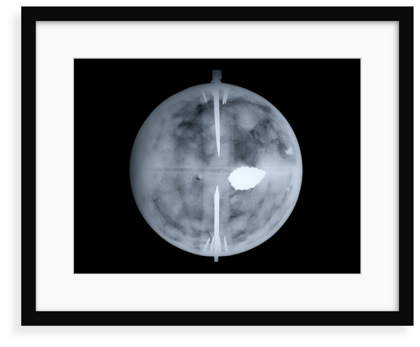 Globe x-ray by Nathaniel Hill