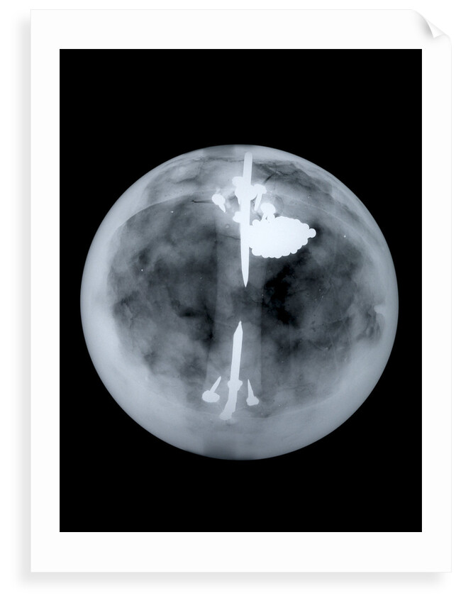 Globe x-ray by Nathaniel Hill