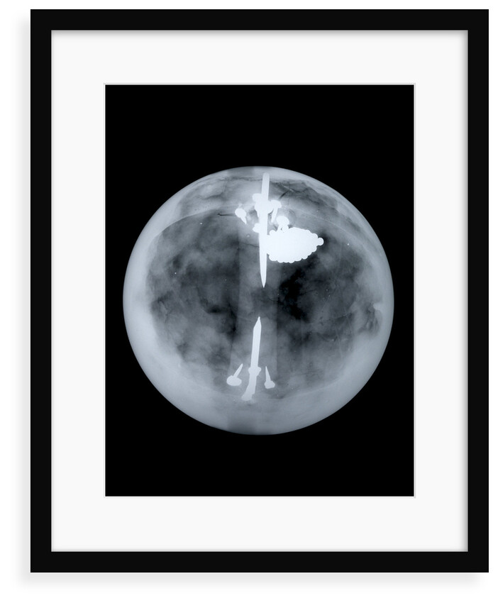 Globe x-ray by Nathaniel Hill