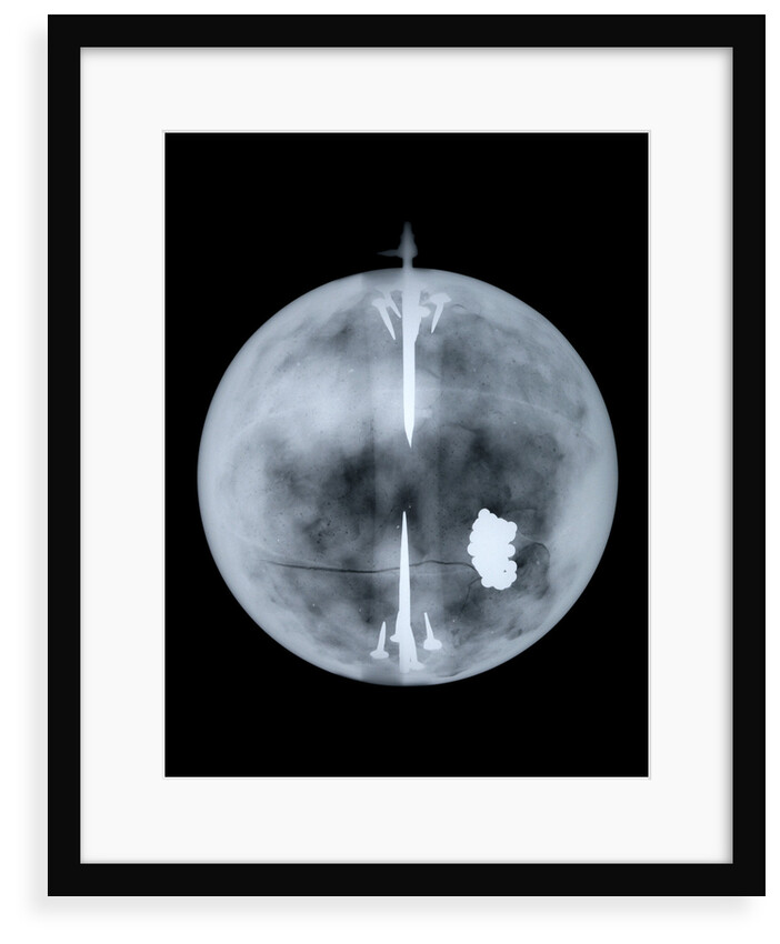 Globe x-ray by Nathaniel Hill