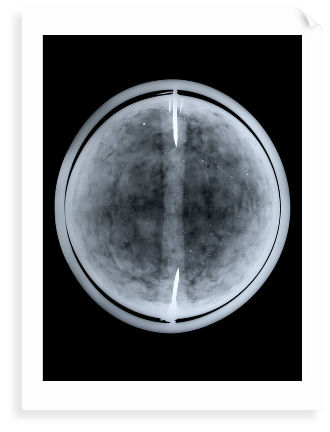 Globe x-ray by William Bardin