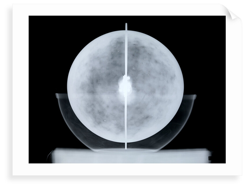 Globe x-ray by William Bardin