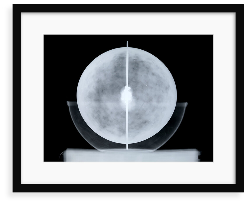 Globe x-ray by William Bardin