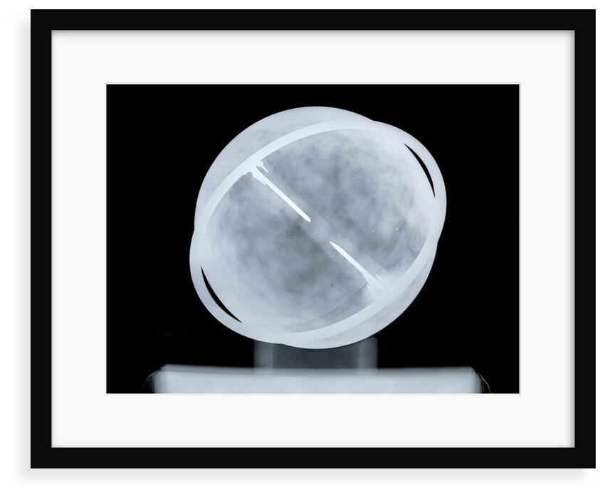 Globe x-ray by William Bardin