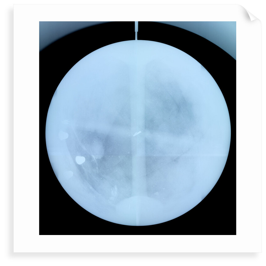 Globe x-ray by Gerard Valk