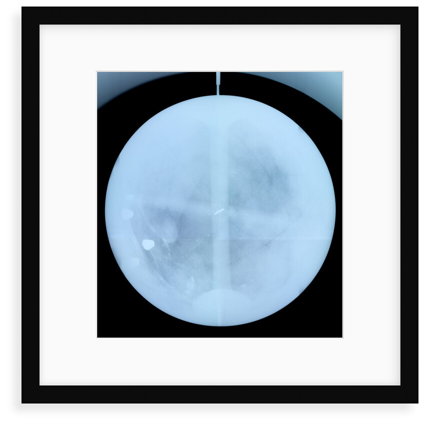 Globe x-ray by Gerard Valk